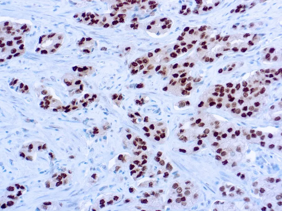 IHC image using GTX29474 - Detection of androgen receptor by IHC in human prostate
