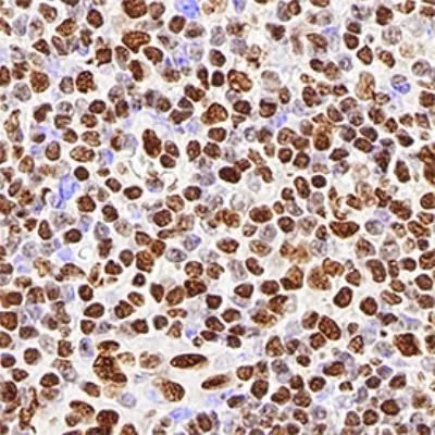 WB analysis of HeLa cell lysate using GTX29547 HNRNP M1-M4 antibody [1D8].