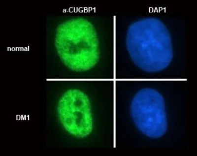 ICC/IF analysis of normal and DM1 (dystrophia myotonica) myoblasts using GTX29549 CUGBP1 antibody [3B1].