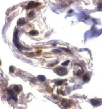 IHC-P analysis of human lung tissue using GTX29651 ARTS antibody. Dilution : 2microg/ml IHC-P analysis of human lung tissue using GTX29651 ARTS antibody. Dilution : 2microg/ml