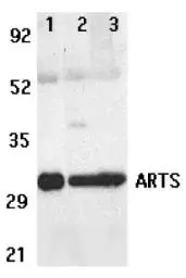 WB analysis of human lung (lane 1),spleen (lane 2), and kidney (lane 3) tissue lysates using GTX29651 ARTS antibody.