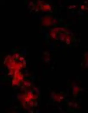 Immunofluorescent staining of Bmf in human kidney tissue with Bmf antibody (GTX29653) at 10microg/ml. Immunofluorescent staining of Bmf in human kidney tissue with Bmf antibody (GTX29653) at 10microg/ml.