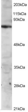 WB analysis of Jurkat lysate using GTX29707 ITK antibody. Dilution : 2microg/ml WB analysis of Jurkat lysate using GTX29707 ITK antibody. Dilution : 2microg/ml