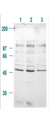 Western blot using GeneTex Immunochemical's Rabbit-anti-GSK3B pS9 antibody.