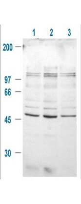 WB analysis of treated and untreated 293T whole cell lysate using GTX29769 GSK3 beta (phospho Ser9) antibody. Lane 1 : Mock Lane 2 : IGF-1 treated whole cell lysate Lane 3 : Pre-teated with LY294002 and treated with IGF-1 whole cell lysate