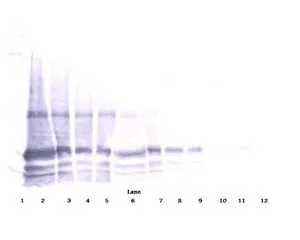 IHC-P analysis of colchicine injected rat brain (cingulate cortex) tissue using GTX29770 IL6 antibody. Working concentration : 1 ug/ml Green : Primary antibody Blue : DAPI Red : Actin