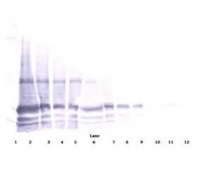 WB analysis of sequential diluted rat IL-6 under either reducing or non-reducing conditions using GTX29770 IL6 antibody. Working concentration : 0.1 - 0.2 ug/ml