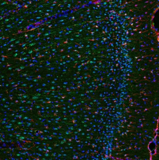 IHC-P analysis of colchicine injected rat brain (cingulate cortex) tissue using GTX29770 IL6 antibody. Working concentration : 1 microg/ml Green : Primary antibody Blue : DAPI Red : Actin