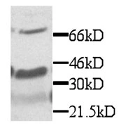 Western blot detection of Fractalkine protein in brain tissue Western blot detection of Fractalkine protein in brain tissue