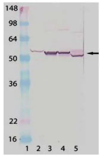 WB analysis of human liver microsome (Lane 2), rat liver microsome (Lane 3), mouse liver microsome (Lane 4), rabbit liver microsome (Lane 5) lysates using GTX30013 Cytochrome P450 antibody.<br>Dilution : 1-5?g/ml