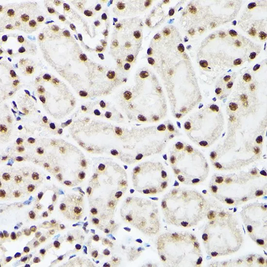 IHC-P analysis of mouse kidney tissue using GTX30021 BAF53A antibody. Dilution : 1:100