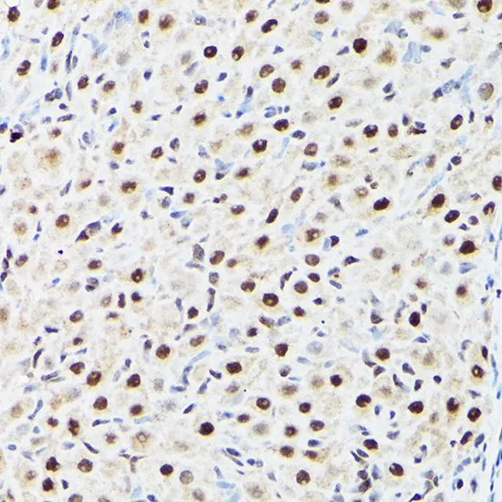 IHC-P analysis of rat ovary tissue using GTX30021 BAF53A antibody. Dilution : 1:100