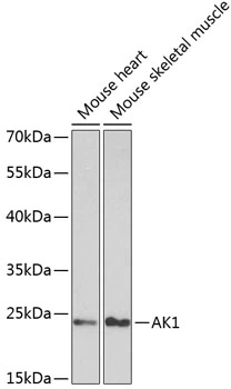 WB analysis of various sample lysates using GTX30037 Adenylate kinase 1 antibody. Dilution : 1:1000 Loading : 25microg per lane WB analysis of various sample lysates using GTX30037 Adenylate kinase 1 antibody. Dilution : 1:1000 Loading : 25microg per lane
