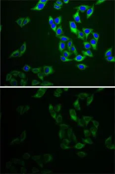 ICC/IF analysis of HeLa cells using GTX30037 Adenylate kinase 1 antibody. Blue : DAPI