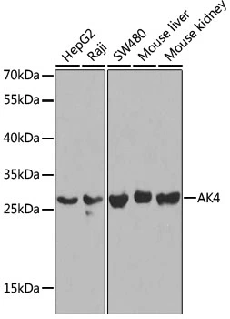 WB analysis of various sample lysates using GTX30038 Adenylate kinase 4 antibody. Dilution : 1:1000 Loading : 25microg per lane