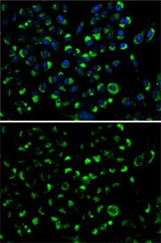 ICC/IF analysis of HeLa cells using GTX30038 Adenylate kinase 4 antibody. Blue : DAPI