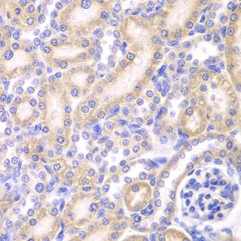 IHC-P analysis of rat kidney tissue using GTX30038 Adenylate kinase 4 antibody. Dilution : 1:200