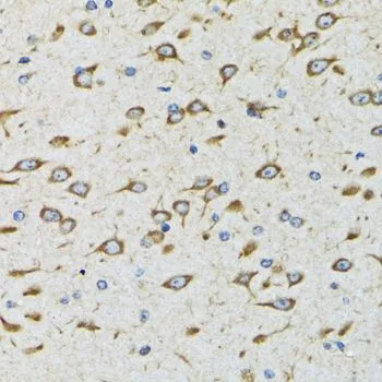 IHC-P analysis of rat brain tissue using GTX30041 FTS antibody. Dilution : 1:100
