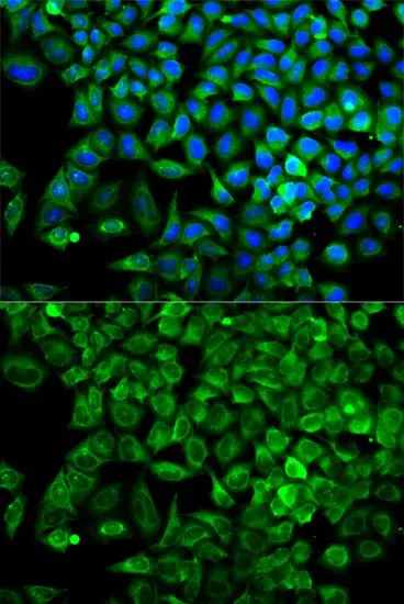 ICC/IF analysis of A549 cells using GTX30044 Aldolase A antibody. Blue : DAPI