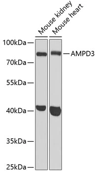 WB analysis of various sample lysates using GTX30046 AMPD3 antibody. Dilution : 1:1000 Loading : 25microg per lane WB analysis of various sample lysates using GTX30046 AMPD3 antibody. Dilution : 1:1000 Loading : 25microg per lane