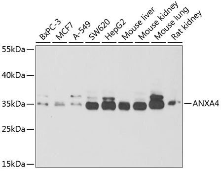 WB analysis of various sample lysates using GTX30048 Annexin IV antibody. The signal was developed with ECL plus-Enhanced. Dilution : 1:1000 Loading : 25microg per lane WB analysis of various sample lysates using GTX30048 Annexin IV antibody. The signal was developed with ECL plus-Enhanced. Dilution : 1:1000 Loading : 25microg per lane