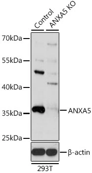 WB analysis of normal (control) and knockout (KO) 293T cell lysate using GTX30049 Annexin V antibody. Dilution : 1:1000 Loading : 25microg per lane WB analysis of normal (control) and knockout (KO) 293T cell lysate using GTX30049 Annexin V antibody. Dilution : 1:1000 Loading : 25microg per lane