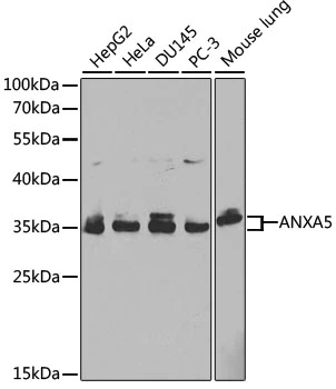WB analysis of various sample lysates using GTX30049 Annexin V antibody. Dilution : 1:1000 Loading : 25microg per lane