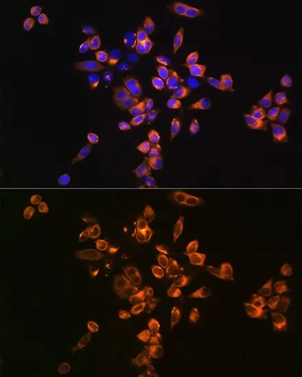 ICC/IF analysis of HeLa cells using GTX30049 Annexin V antibody. Blue : DAPI Dilution : 1:100