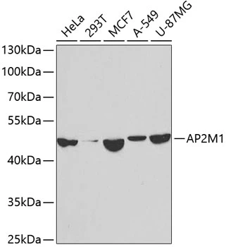 WB analysis of various sample lysates using GTX30052 AP2M1 antibody. Dilution : 1:1000 Loading : 25microg per lane WB analysis of various sample lysates using GTX30052 AP2M1 antibody. Dilution : 1:1000 Loading : 25microg per lane