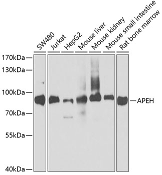 WB analysis of various samples using GTX30054 APEH antibody. Dilution : 1:1000 Loading : 25ug per lane