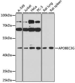 WB analysis of various sample lysates using GTX30056 APOBEC3G antibody. Dilution : 1:1000 Loading : 25microg per lane WB analysis of various sample lysates using GTX30056 APOBEC3G antibody. Dilution : 1:1000 Loading : 25microg per lane