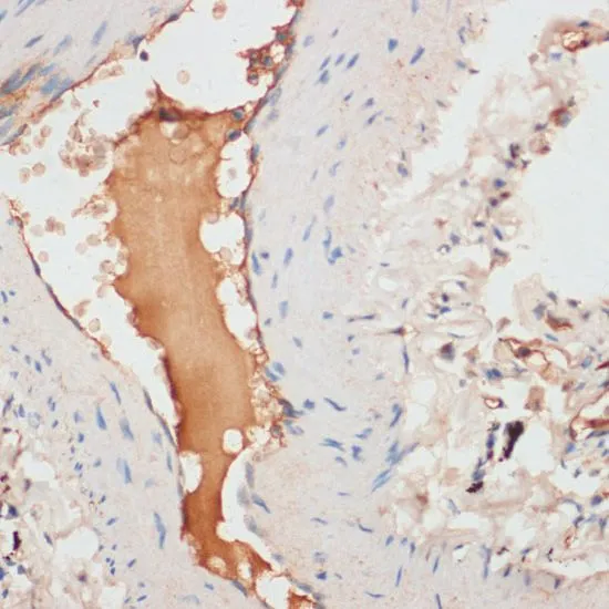 IHC-P analysis of human lung tissue using GTX30057 Apolipoprotein CI antibody. Dilution : 1:100 IHC-P analysis of human lung tissue using GTX30057 Apolipoprotein CI antibody. Dilution : 1:100