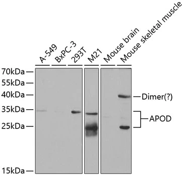 WB analysis of various sample lysates using GTX30058 Apolipoprotein D antibody. Dilution : 1:1000 Loading : 25microg per lane WB analysis of various sample lysates using GTX30058 Apolipoprotein D antibody. Dilution : 1:1000 Loading : 25microg per lane