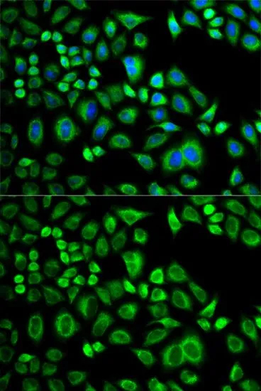 ICC/IF analysis of A549 cells using GTX30058 Apolipoprotein D antibody. Blue : DAPI