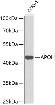 WB analysis of 22Rv1 cell lysate using GTX30060 Apolipoprotein H antibody. Dilution : 1:1000 Loading : 25microg per lane