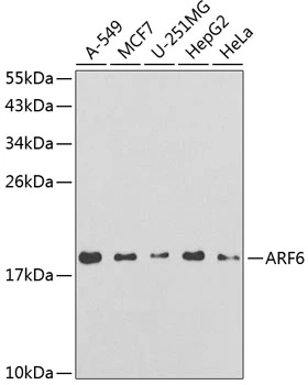 WB analysis of various sample lysates using GTX30062 ARF6 antibody. Dilution : 1:250 Loading : 25microg per lane WB analysis of various sample lysates using GTX30062 ARF6 antibody. Dilution : 1:250 Loading : 25microg per lane