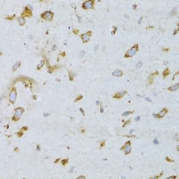 IHC-P analysis of rat brain tissue using GTX30062 ARF6 antibody. Dilution : 1:100