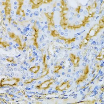 IHC-P analysis of rat kidney tissue using GTX30062 ARF6 antibody. Dilution : 1:100