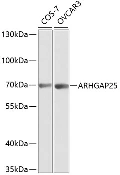 WB analysis of various sample lysates using GTX30063 ARHGAP25 antibody. Dilution : 1:1000 Loading : 25microg per lane WB analysis of various sample lysates using GTX30063 ARHGAP25 antibody. Dilution : 1:1000 Loading : 25microg per lane