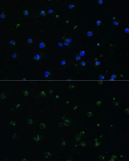 ICC/IF analysis of Jurkat cells using GTX30063 ARHGAP25 antibody. Blue : DAPI Dilution : 1:100