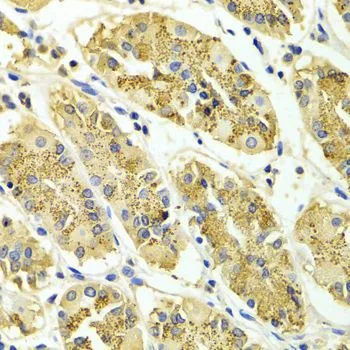IHC-P analysis of human gastric tissue using GTX30063 ARHGAP25 antibody. Dilution : 1:100