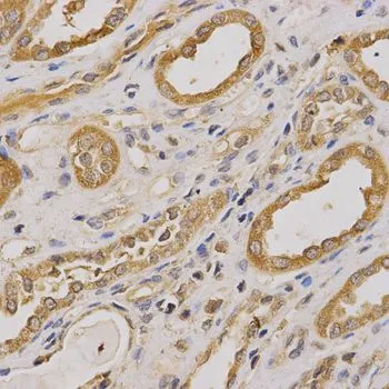 IHC-P analysis of human kidney tissue using GTX30063 ARHGAP25 antibody. Dilution : 1:200
