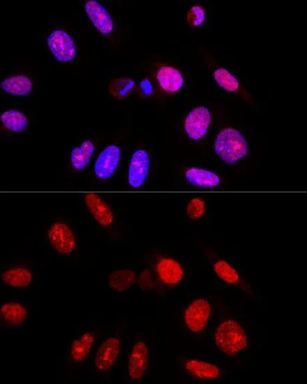 ICC/IF analysis of U2OS cells using GTX30079 Ataxin 3 antibody. Blue : DAPI Dilution : 1:100