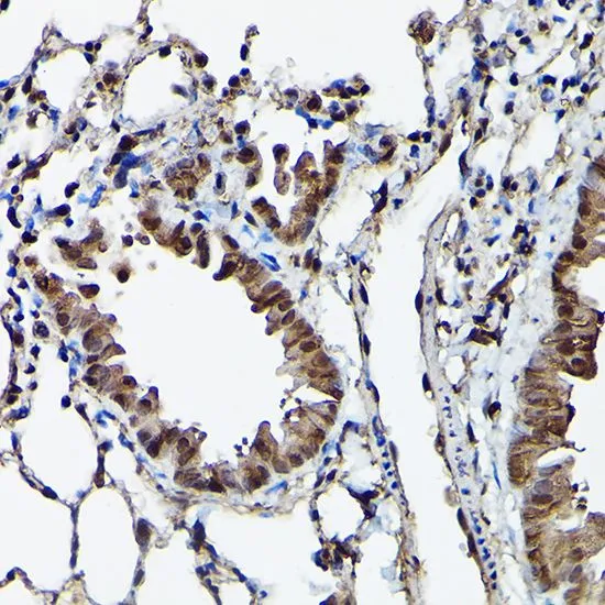 IHC-P analysis of mouse lung tissue using GTX30079 Ataxin 3 antibody. Dilution : 1:100