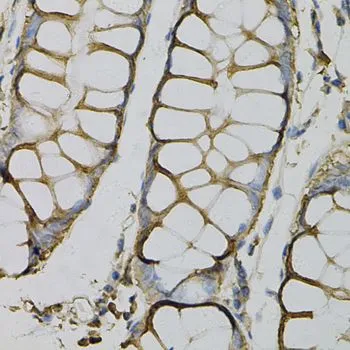 IHC-P analysis of human colon tissue using GTX30081 AZGP1 antibody. Dilution : 1:100
