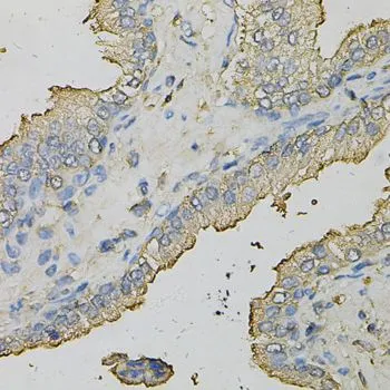 IHC-P analysis of human prostate tissue using GTX30081 AZGP1 antibody. Dilution : 1:100