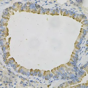 IHC-P analysis of mouse lung tissue using GTX30081 AZGP1 antibody. Dilution : 1:100