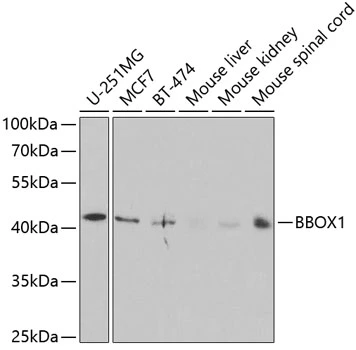 WB analysis of various sample lysates using GTX30083 BBOX1 antibody. Dilution : 1:1000 Loading : 25microg per lane WB analysis of various sample lysates using GTX30083 BBOX1 antibody. Dilution : 1:1000 Loading : 25microg per lane
