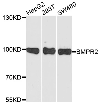 WB analysis of various sample lysates using GTX30090 BMPR2 antibody. Dilution : 1:1000 Loading : 25microg per lane