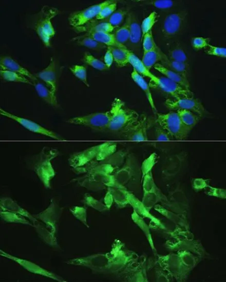 ICC/IF analysis of U2OS cells using GTX30090 BMPR2 antibody. Blue : DAPI Dilution : 1:100